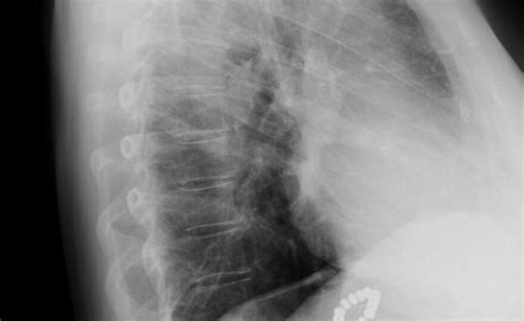 Image result for Linx Device