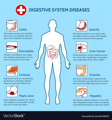 Digestive System Diseases 的图像结果