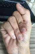 Image result for fingered