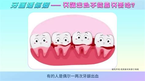 牙龈出血，用什么牙膏可以治好？听专业牙医怎么说_凤凰网视频_凤凰网