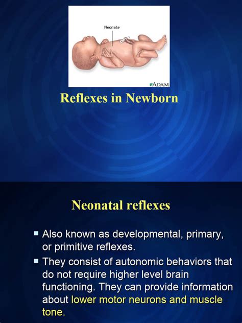 Newborn Reflex 的图像结果