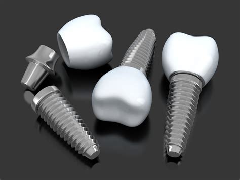 Bionic Teeth - What Are Dental Implants? Types of Dental Implants | Great Lakes Dentistry Royal Oak