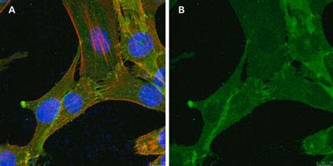 Anti-GNA-11 (G alpha 11) Antibody, clone 1F16 ZooMAb® Rabbit Monoclonal ...