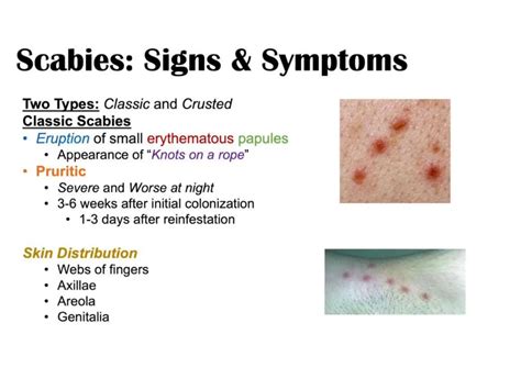 Clinical Pharmacotherapy of Scabies Disease | PPTX