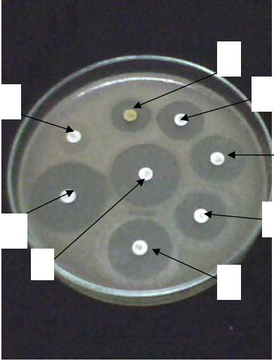 Disc Diffusion Method Kit 的图像结果