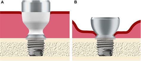 Healing Frequency Sounds DNA 的图像结果