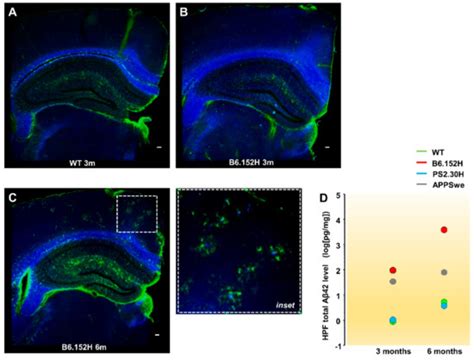 Dampened Slow Oscillation Connectivity Anticipates Amyloid Deposition ...