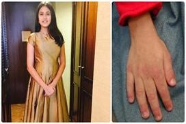 सोते वक्त क्यों बहती है लार? जानिए कारण - why-flows-saliva-when-you ...