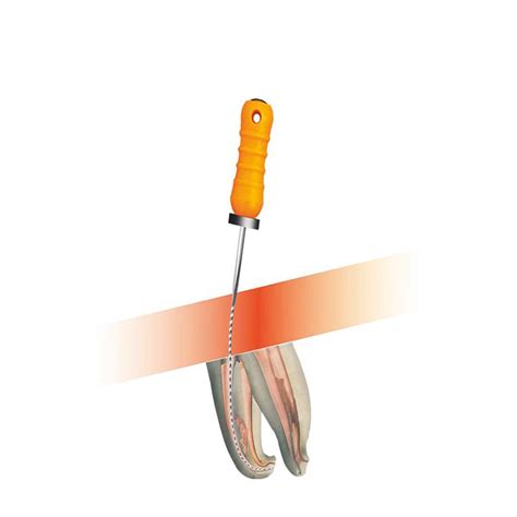 NeoEndo NeoProbe Files (Pack of 6) Endodontic Dental Files – Dental Prod