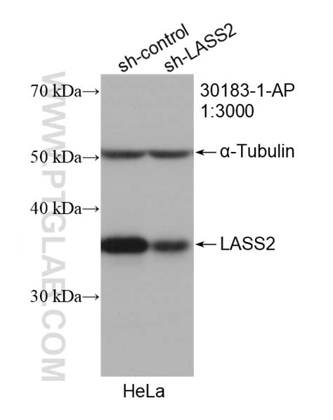 LASS2 antibody (30183-1-AP) | Proteintech