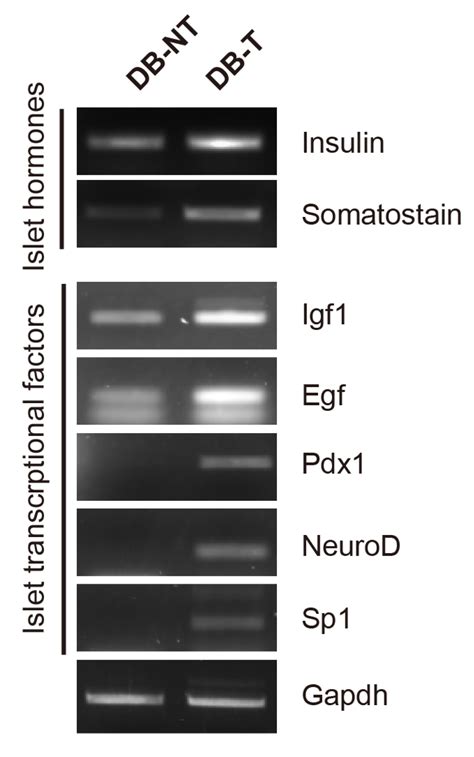 Silk Fibroin Promotes the Regeneration of Pancreatic β-Cells in the ...