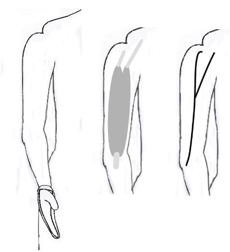 Image result for Tension Force Muscle Graph