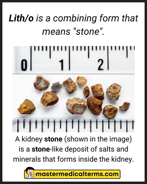 Common Word Roots for Disease - Master Medical Terms
