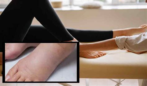 Feet Swelling : పాదాల్లో వాపులా!...సమస్యేంటో తెలుసుకోవాల్సిందే ...