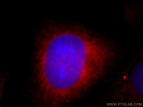 SH3BP1 antibody (20541-1-AP) | Proteintech