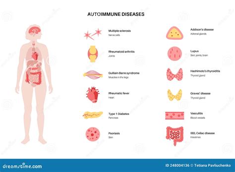 Vasculitis And Autoimmune Diseases