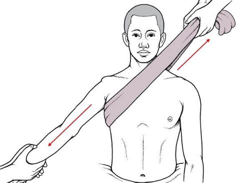 Image result for Shoulder Reduction Methods