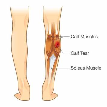 https://dynamicphysio.co.nz/wp-content/uploads/2019/07/shutterstock_524945713.jpg