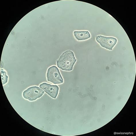 What Are Squamous Epithelial In Urine at Mai Lowder blog