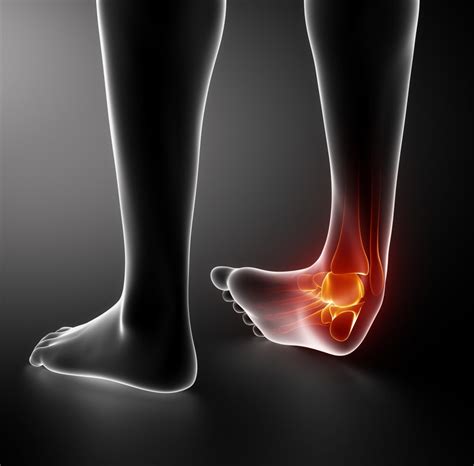 Ankle Sprains and Instability - Movement and Wellbeing Clinic
