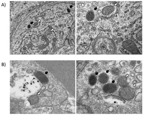 Physiological Translocation of Lactic Acid Bacteria during Pregnancy ...