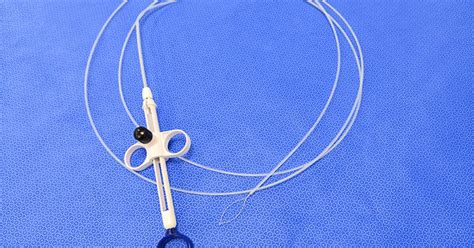 Image result for Post-Polypectomy Care