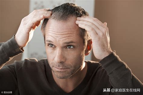 老掉头发是怎么回事（20岁就总是掉头发？多半是这3个原因，不是遗传惹的祸） | 说明书网