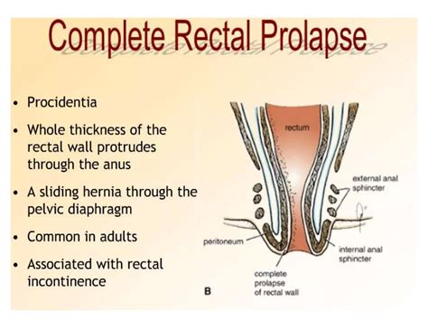 Anatomy of Rectum.pptx - anatomy of rectum