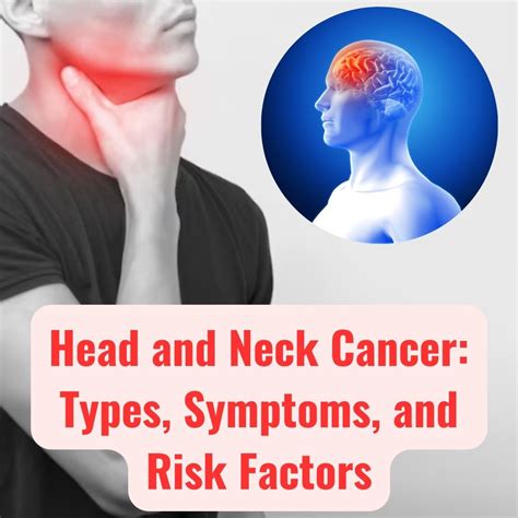 Head and Neck Cancer: Types, Symptoms, and Risk Factors