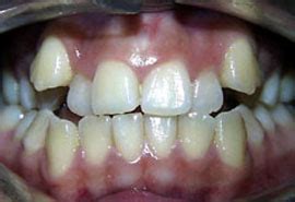 Dental Clinic in New Delhi, Dentist in Delhi, Dental Clinic in South ...