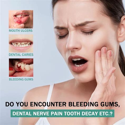 KOAHDE Gum Repair Spray - Relief for Sore Gums, Toothaches, and Muscle Pain | Buy Now with ...