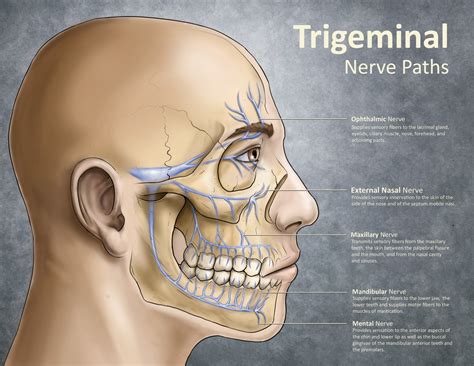 Trigeminal Neuralgia: April 2015