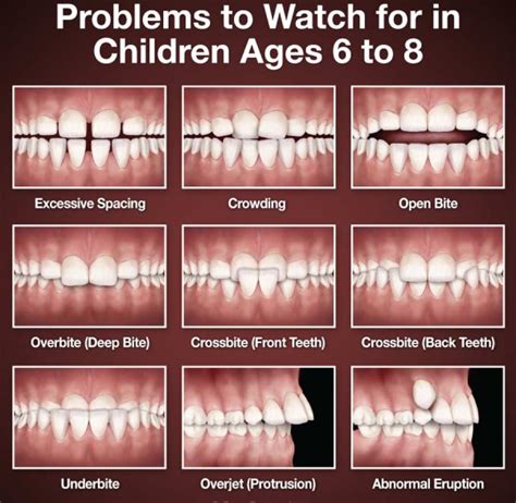 Early Dental Care | Riehl Dental Care for Kids