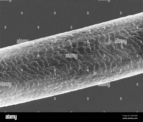 Animal Hair Under Microscope