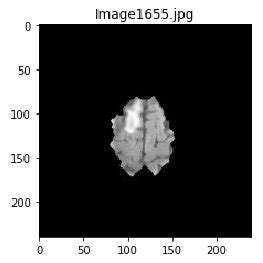 Image result for Brain Tumor Detection Using Machine Learning