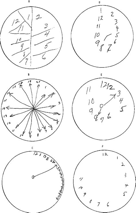 Clock Draw 的图像结果