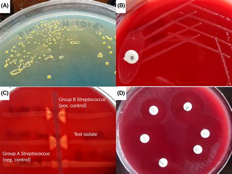 Streptococcus Group A Gram Stain