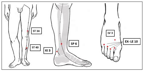 Acupuncture in Patients with Diabetic Peripheral Neuropathy-Related ...