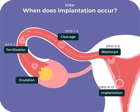 How Soon After Iui Can Implantation Occur | Detroit Chinatown