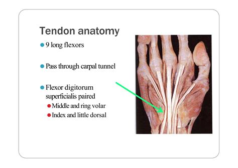 Flexor tendon injuries- basics for orthopedics residents | PPT