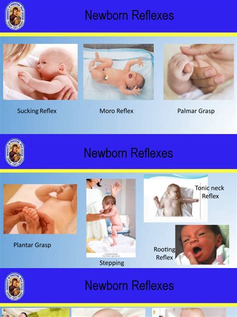 Newborn Reflex 的图像结果