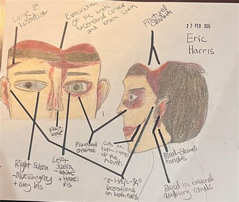 Visual Depiction of Eric Harris’ Injuries/aftermath : r/ColumbineKillers