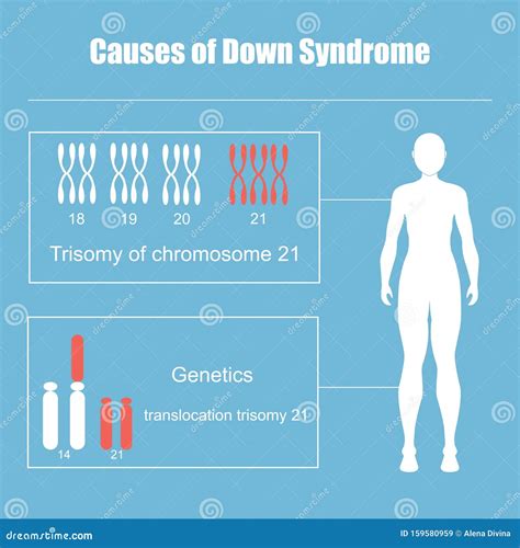 Trisomy Chromosome