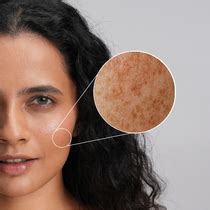 Best Organic Skin Care Products in India – Vanaura Organics