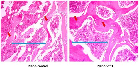 Stabilization of Vitamin D in Pea Protein Isolate Nanoemulsions ...