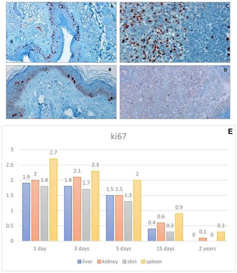 Antigenicity Preservation Is Related to Tissue Characteristics and the ...