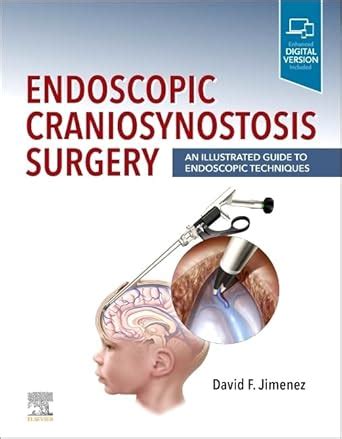 Endoscopic Craniosynostosis Surgery: An Illustrated Guide to Endoscopi