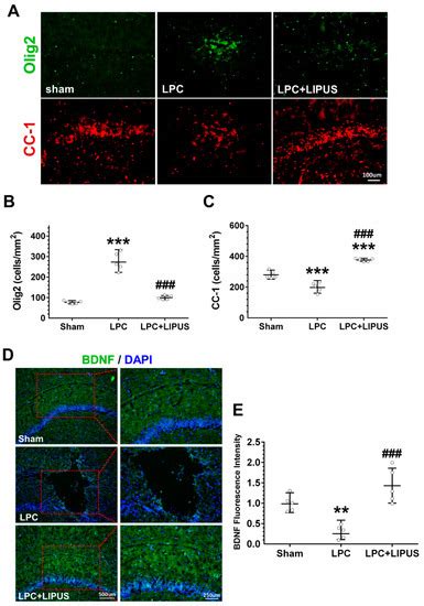 Ultrasound Neuromodulation Reduces Demyelination in a Rat Model of ...