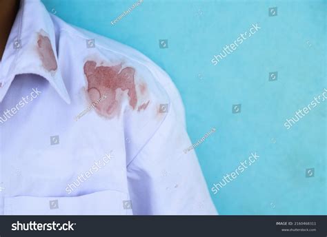 146 Cleaning Spilled Blood Images, Stock Photos & Vectors | Shutterstock