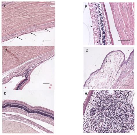 The Role of Cryotherapy in Vitreous Concentrations of Topotecan ...